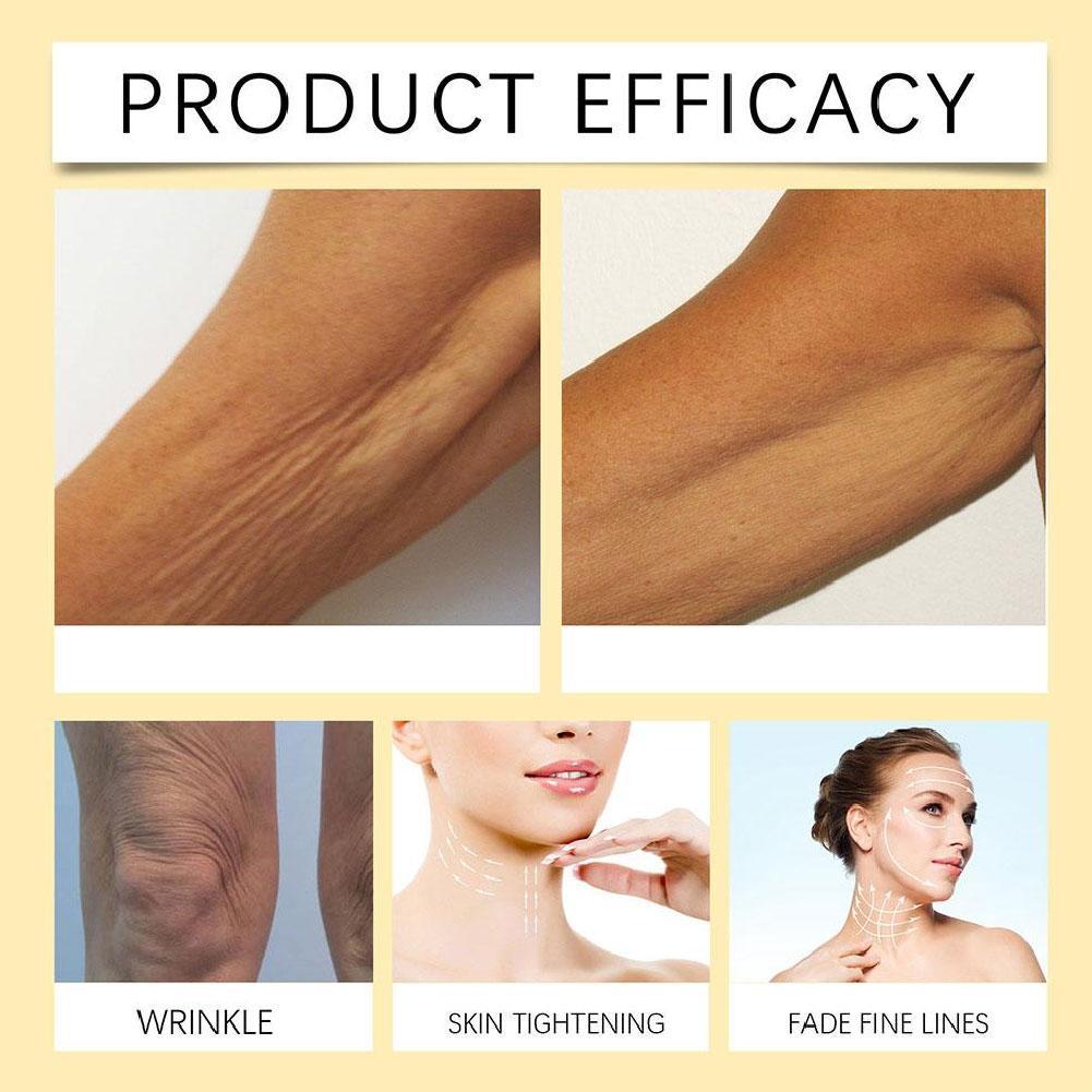 셀리맥스 레티놀 세럼은 잔주름을 완화하고, 피부 탄력을 - The Ordinary Serum Hyaluronic Acid 리뷰 및 가격